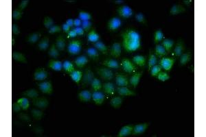 Immunofluorescence staining of Hela cells with ABIN7145166 at 1:133, counter-stained with DAPI. (Cyclin D1 antibody  (AA 1-233))