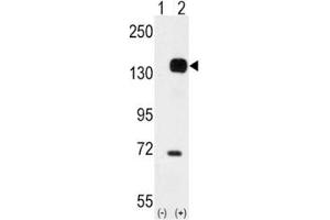 Western Blotting (WB) image for anti-TEK Tyrosine Kinase, Endothelial (TEK) (AA 758-789) antibody (ABIN3029103)