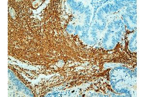 Immunohistochemistry (IHC) image for anti-Neurofilament 150, 200kD antibody (ABIN108435) (Neurofilament 150, 200kD antibody)