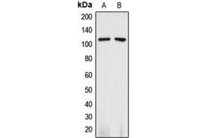 Western blot analysis of CD13 expression in A375 (A), THP1 (B) whole cell lysates. (CD13 antibody  (C-Term))