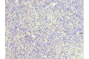 Immunohistochemistry of paraffin-embedded human thymus tissue using ABIN7147523 at dilution of 1:100 (CHMP2B antibody  (AA 1-213))