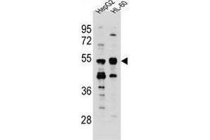 TEKT5 Antibody (Center) western blot analysis in HepG2,HL-60 cell line lysates (35 µg/lane). (TEKT5 antibody  (Middle Region))