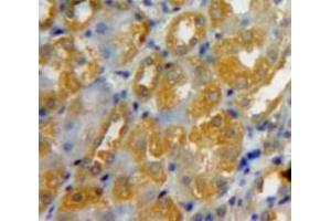 Used in DAB staining on fromalin fixed paraffin-embedded Kidney tissue (COL4a2 antibody  (AA 1487-1703))
