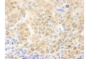 Immunohistochemistry (IHC) image for anti-Mitogen-Activated Protein Kinase Kinase 1 (MAP2K1) (AA 343-393) antibody (ABIN7448664)