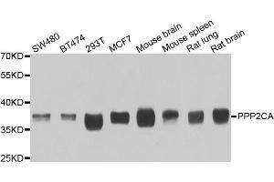 Western blot analysis of extracts of various cell lines, using PPP2CA antibody. (PPP2CA antibody)