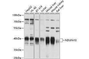 Western blot analysis of extracts of various cell lines, using NDUF antibody (123) at 1:1000 dilution. (NDUFA10 antibody  (AA 36-300))