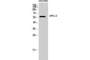 Western Blotting (WB) image for anti-G Protein-Coupled Receptor 114 (GPR114) (Internal Region) antibody (ABIN3184837) (GPR114 antibody  (Internal Region))