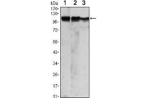 Western blot analysis using HK2 mouse mAb against Jurkat (1), Hela (2) and HEK293 (3) cell lysate. (Hexokinase 2 antibody)