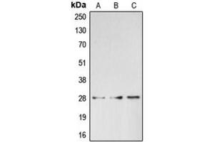 Western blot analysis of BRMS1 expression in HepG2 (A), HeLa (B), K562 (C) whole cell lysates.