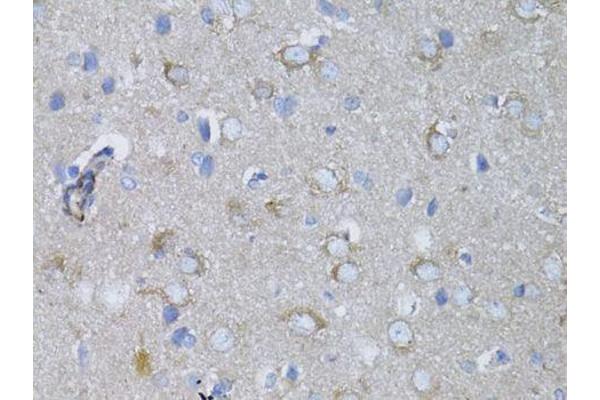 MYH10 antibody  (AA 1908-2007)