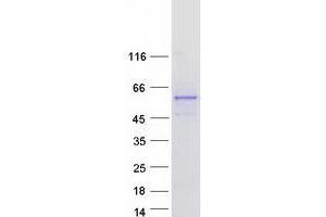 Validation with Western Blot (Fam90a18 Protein (Myc-DYKDDDDK Tag))