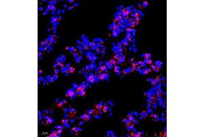 Immunofluorescence of paraffin embedded mouse lung using P4H (ABIN7074215) at dilution of 1:700 (400x lens) (HIF Prolyl Hydroxylase antibody)