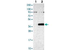 Western blot analysis of Lane 1: Negative control (vector only transfected HEK293T lysate), Lane 2: Over-expression Lysate (Co-expressed with a C-terminal myc-DDK tag (~3. (ZNF177 antibody)