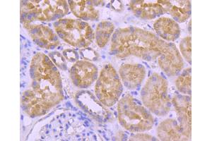 Paraformaldehyde-fixed, paraffin embedded human kidney section, Antigen retrieval by boiling in sodium citrate buffer (pH6) for 15min, Block endogenous peroxidase by 3% hydrogen peroxide for 30 minutes, Blocking buffer at 37°C for 20min, Antibody incubation with A-RAF (24D1) Monoclonal Antibody  at 1:50 overnight at 4°C, followed by a conjugated secondary and DAB staining. (ARAF antibody)