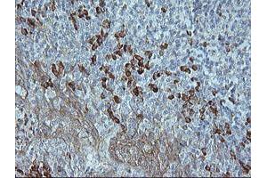 Image no. 2 for anti-Mitogen-Activated Protein Kinase 9 (MAPK9) antibody (ABIN1498927) (JNK2 antibody)