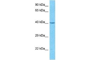 Host:  Rabbit  Target Name:  PSMD6  Sample Type:  MCF7 Whole Cell lysates  Antibody Dilution:  1.
