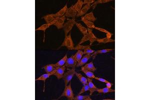 Immunofluorescence analysis of NIH/3T3 cells using NMN Rabbit pAb (ABIN7268910) at dilution of 1:100. (NMNAT3 antibody  (AA 1-215))