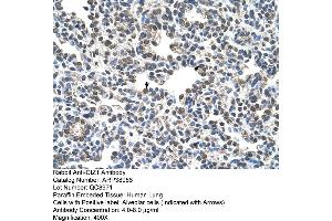 Human Lung (CIZ1 antibody  (C-Term))