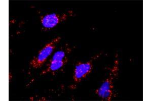 Proximity Ligation Analysis of protein-protein interactions between DKK1 and CTNNB1. (DKK1 antibody  (AA 1-266))
