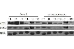 COX protein levels in xenograft tumors of nude mice treated or not treated with combined treatment of SC-560 and celecoxib. (PTGS1 antibody  (AA 151-250))