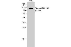 Western Blotting (WB) image for anti-Collagen, Type I, alpha 2 (COL1A2) (cleaved), (Gly1102) antibody (ABIN3181801) (COL1A2 antibody  (cleaved, Gly1102))