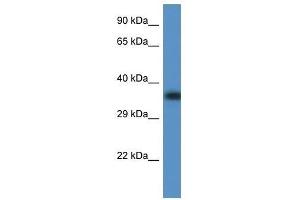 Western Blot showing Fbxo32 antibody used at a concentration of 1. (FBXO32 antibody  (C-Term))