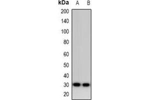 Western blot analysis of Calsarcin 1 expression in HepG2 (A), MDAMB453 (B) whole cell lysates. (MYOZ2 antibody)
