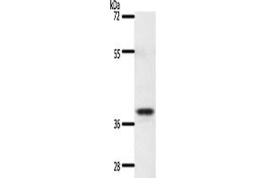 Gel: 10 % SDS-PAGE, Lysate: 60 μg, Lane: Mouse thymus tissue, Primary antibody: ABIN7192661(SSTR5 Antibody) at dilution 1/350, Secondary antibody: Goat anti rabbit IgG at 1/8000 dilution, Exposure time: 20 seconds (SSTR5 antibody)