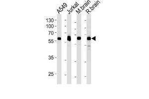 Western Blotting (WB) image for anti-Ubiquitin Specific Peptidase 14 (USP14) antibody (ABIN3004701) (USP14 antibody)