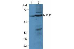Figure. (LPCAT3 antibody  (AA 122-233))