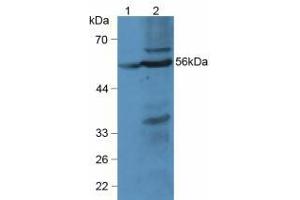 Figure. (LPCAT3 antibody  (AA 122-233))