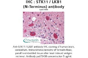 Image no. 2 for anti-serine/threonine Kinase 11 (STK11) antibody (ABIN1739721) (LKB1 antibody)