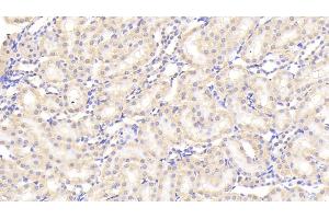 Detection of SAP in Rat Kidney Tissue using Polyclonal Antibody to Serum Amyloid P Component (SAP) (APCS antibody  (AA 22-222))