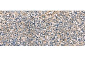 Immunohistochemistry of paraffin-embedded Human tonsil tissue using APOBR Polyclonal Antibody at dilution of 1:35(x200) (APOBR antibody)