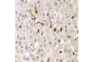 Immunohistochemistry of paraffin-embedded human liver injury using SPN antibody (ABIN5973813) at dilution of 1/100 (40x lens). (CD43 antibody)