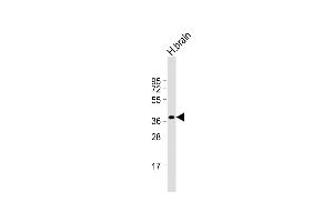 Anti-CEAC Antibody (N-term) at 1:1000 dilution + human brain lysate Lysates/proteins at 20 μg per lane. (CEACAM18 antibody  (N-Term))