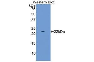 Detection of Recombinant LAMC2, Human using Polyclonal Antibody to Laminin Gamma 2 (LAMC2) (LAMC2 antibody  (AA 28-196))