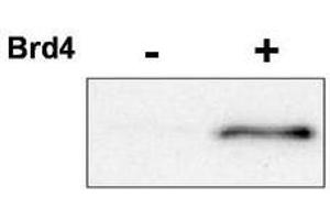 Image no. 1 for anti-Cyclin-Dependent Kinase 9 (CDK9) (pThr29) antibody (ABIN292281) (CDK9 antibody  (pThr29))