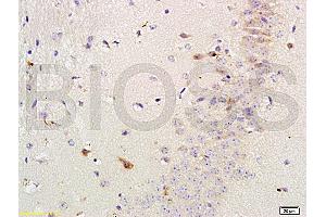 Formalin-fixed and paraffin-embedded mouse brain labeled with Rabbit Anti-Versican Polyclonal Antibody, Unconjugated (ABIN741660) 1:200 followed by conjugation to the secondary antibody and DAB staining (Versican antibody  (AA 3301-3396))