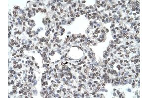TMPRSS11D antibody was used for immunohistochemistry at a concentration of 4-8 ug/ml to stain Alveolar cells (arrows) in Human Lung. (TMPRSS11D antibody  (N-Term))