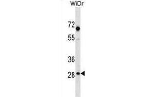 Western Blotting (WB) image for anti-Sorting Nexin 11 (SNX11) antibody (ABIN3000505)