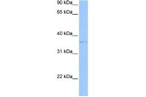 TREML2 antibody used at 1 ug/ml to detect target protein. (TREML2 antibody  (Middle Region))