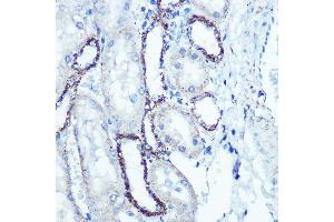 Western blot analysis of extracts of various cell lines, using ATPB antibody (ABIN7265722) at 1:153000 dilution. (ATP5B antibody)