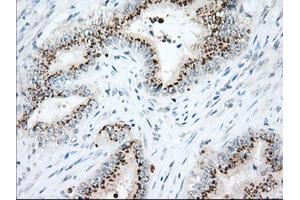 Immunohistochemistry (IHC) image for anti-Heat Shock 70kDa Protein 1A (HSPA1A) antibody (ABIN1498743) (HSP70 1A antibody)