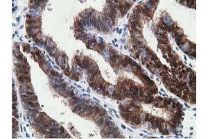 Image no. 3 for anti-Hydroxyprostaglandin Dehydrogenase 15-(NAD) (HPGD) antibody (ABIN1496361) (HPGD antibody)