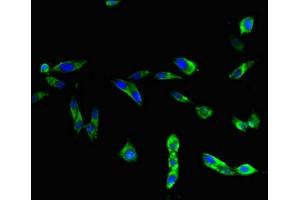 Immunofluorescent analysis of Hela cells using ABIN7172270 at dilution of 1:100 and Alexa Fluor 488-congugated AffiniPure Goat Anti-Rabbit IgG(H+L) (TLR3 antibody  (AA 135-297))