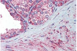 Prostate, Human: Formalin-Fixed, Paraffin-Embedded (FFPE) (SOD2 antibody)