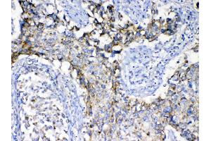 IHC analysis of SCF using anti-SCF antibody . (KIT Ligand antibody  (AA 26-190))