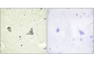 Immunohistochemistry analysis of paraffin-embedded human brain tissue, using M-CSF Receptor (Ab-723) Antibody. (CSF1R antibody  (AA 691-740))