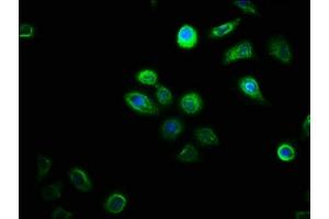 Immunofluorescence staining of A549 cells with ABIN7149631 at 1:100, counter-stained with DAPI. (DHRSX antibody  (AA 32-330))